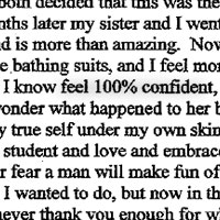 Dr. Kulick, When I was 15 years old I had noticed that something was different about my body compared to other girls. As I grew with my body into my teen years of middle school and high school I found I was not happy with the way my body looked. I felt that I did not look like a normal female and felt I was not a woman or as good as my other friends whose breasts had developed together. I am left handed and noticed when I hit puberty that my breasts were growing at different rates and sizes. This made me extremely self conscious, brought me down, and made me feel like no one would like me for my true self. Growing up in today's society there is such a emphasis on woman's appearance its pathetic. But as a young woman growing into your body and not feeling comfortable with my self was the worst feeling I have ever felt. I felt that I could not wear a bathing suit, tank tops, or shirts that would show the fact that one breast was smaller than the other for fear of what others would think. All my girlfriends had the same size breast and didn't face the problem I did. As time went on and I grew up I was able to hide my problem quite well, but when it came down to it I would never let a man get close to me for fear of thinking I was not like every other girl and that I was different. My freshman year in college came around and I felt that it was time to fix this problem and make me feel like a woman and let my true self shine. I had looked in to taking fat cells from other parts of my body and injecting it into my right breast that was smaller than my left. As this reality came true that, that was not an option I knew that I did not want implants for fear of surgery and fake breasts. My sophomore year came around and my older sister approached me with a problem of her own, breasts were non-existent and one was bigger than the other as well. This was a very emotional time to realize that both girls in the same family had the same problem. My sister then told me that she had been doing research and found that the only way to solve our problem was to get breast implants. For me this was the last thing that I wanted to do but if I was going to feel, look and see my self as a woman then I was willing to go for it. The hardest part was confronting my mother and telling her about the pain, agony, and discomfort we felt with our breast problem. We then found Dr. Kulick and decided to see what he could do for us. Twenty minutes into the consultation we both decided that this was the thing and way to go for us to feel like real woman. Two months later my sister and I went under the knife and when we came out the result was and is more than amazing. Now a year later, I can wear and fit into anything, I have over five bathing suits, and I feel more comfortable with my self and discovered who I truly was. I know feel 100% confident, I am more social, and feel people don't look at me and wonder what happened to her breast. Most importantly though surgery helped me find my true self under my own skin and now I am happier than I ever have been. I am a nursing student and love and embrace life to its fullest, I don't hide in the shadows anymore or fear a man will make fun of me. In the beginning this was the LAST thing that I wanted to do, but now in the end I would never go back and not have surgery. I could never thank you enough for what you have done for me. I feel like a woman now and would recommend the surgery to anyone. I look forward to possibly working with you in the future whether it be an internship or a letter of recommendation to another plastic surgeon, I thank you for giving me the chance to feel like the woman I am!