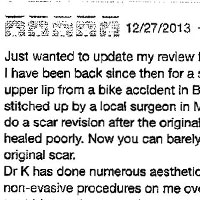 Just wanted to update my review from 2008: I have been back since then for a scar revision on my upper lip from a bike accident in Burma. After having been stitched up by a local surgeon in Mandalay, I had Dr K do a scar revision after the original wound/stitches had healed poorly. Now you can barely see the site of the original scar. Dr K has done numerous aesthetic, reconstructive and non-evasive procedures on me over the last 20 years. I trust him to give me an honest evaluation and know that he is the best. From 8/12/2008: Dr Kulick has performed multiple procedures on me over the last 15 years. He reconstructed my nose after having broken it 3 times as a child. I was able to breath fully from both nostrils for the first time since I was 8. He has also done aesthetic work on me that has produced natural age appropriate results. Dr Michael Kulick is one of the finest cosmetic surgeons in the country. He an excellent practitioner as well as an innovator of surgical techniques. He operates in the optimal safety of a hospital, not an in office surgical suite. He gives back to the community by doing pro bono and burn patient work to those in need. His office staff has been with him for many years and are as caring and professional as they come. I wouldn't hesitate in recommending Dr Kulick to anyone for cosmetic or reconstructive surgery.