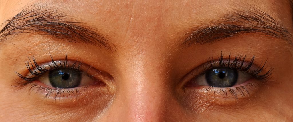 best treatment for sagging eyelids