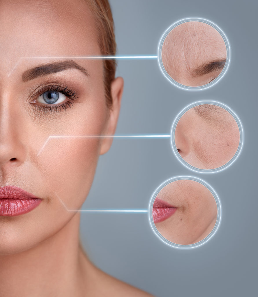 Liquid facelift or surgical facelift options