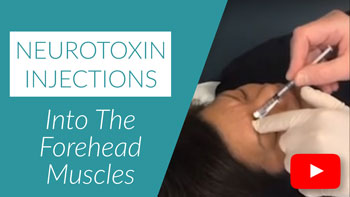 Injecting Neurotoxins Into the Forehead