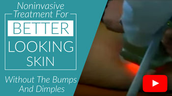 Non-Invasive Cellulite Treatment